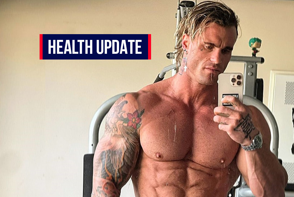 BodyBuilder Calum Von Moger: All you want to know about BodyBuilder Calum Von Moger Health updates from ICU, check why did he jump from his two storey apartment? 