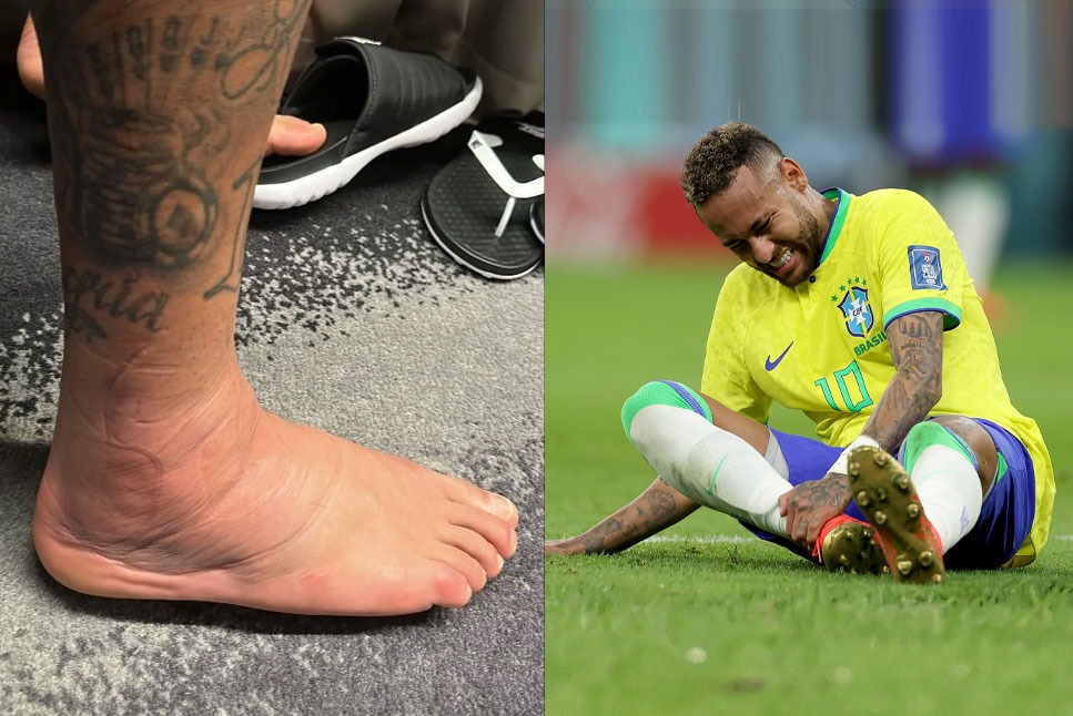 Brazil Football Team, FIFA World Cup, Neymar Injury, FIFA World Cup 2022, Brazil vs Switzerland, Brazil WC Squad, Neymar Injury Latest, Swollen Ankle 