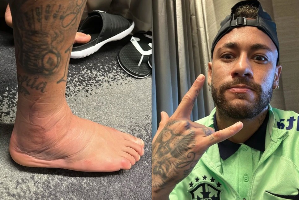 Neymar memposting foto KAKI BENGKAK & MENGERIKAN, PERIKSA INI!  Ikuti Pembaruan LANGSUNG dari Brazil Camp